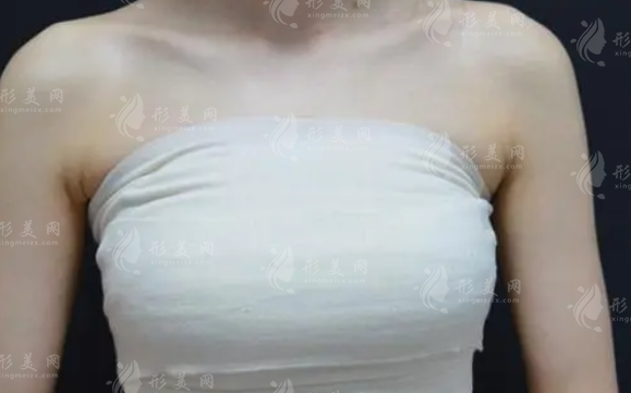 杭州美萊沈正宇醫(yī)生隆胸優(yōu)勢，坐診醫(yī)院信息、2024價(jià)格表更新