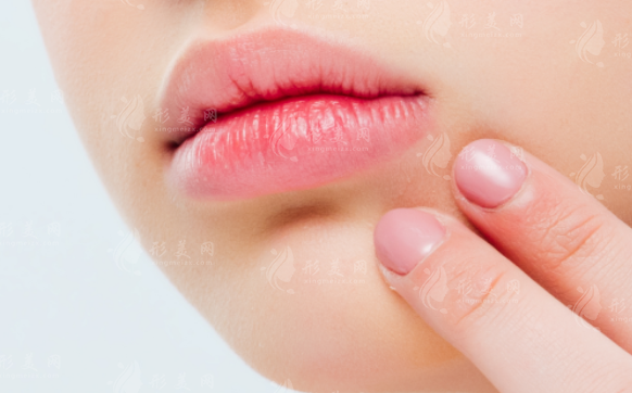 厚唇改薄手術(shù)是永久性的嗎？