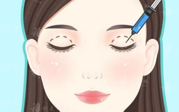 重慶藝星整形做雙眼皮多少錢？好評(píng)醫(yī)生信息、案例品鑒、收費(fèi)表