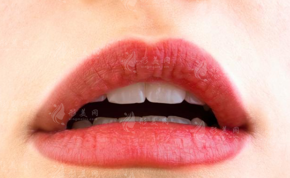 上海九院整形外科厚唇改薄多少錢？口碑醫(yī)生信息、收費(fèi)價格表