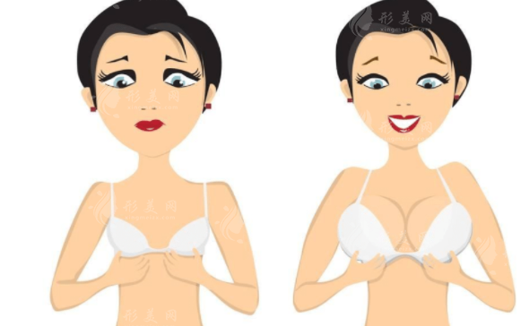 微創(chuàng)假體豐胸的副作用與預(yù)防措施