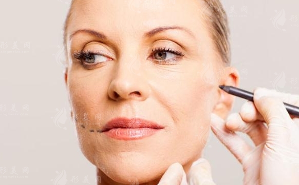 面中部除皺術：步驟、適應癥及其影響