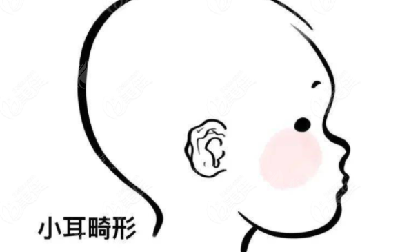 上海九院耳再造技術(shù)怎么樣？專家介紹、案例參考、附收費(fèi)價(jià)格表