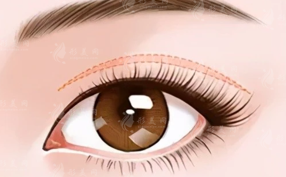 上海時(shí)光整形雙眼皮多少錢？手術(shù)醫(yī)生介紹、案例分享、附價(jià)格