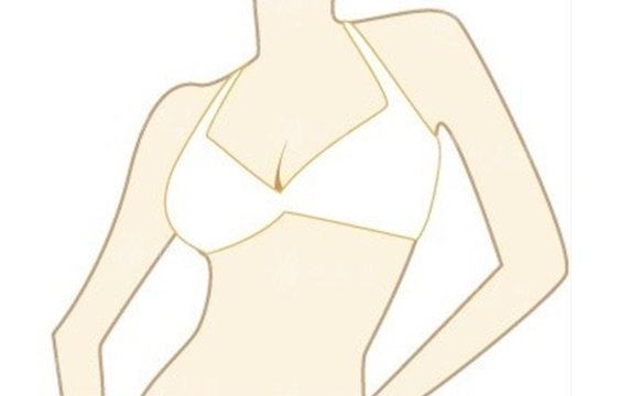 乳暈縮小手術：效果與乳房影響探究