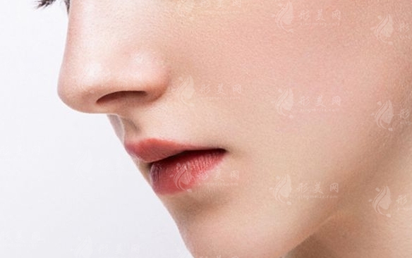 耳軟骨墊鼻尖：去除的難易與恢復的時間