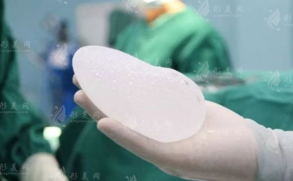 不適合假體隆胸的人群分析