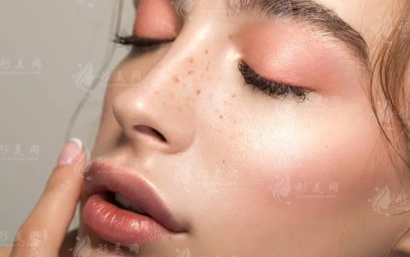 激光祛斑的優(yōu)勢及結(jié)痂脫落時間 激光祛斑的優(yōu)勢及結(jié)痂脫落時間