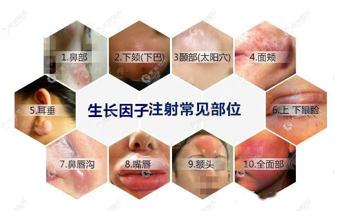 南方醫(yī)院取生長因子費用多少錢？取生長因子影響因素分析