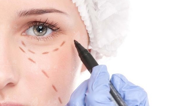 手術(shù)去除黑眼圈：效果真的永久嗎？