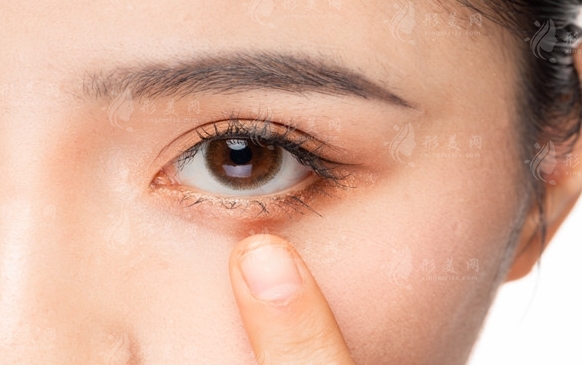 臥蠶手術(shù)的風(fēng)險與填充方法