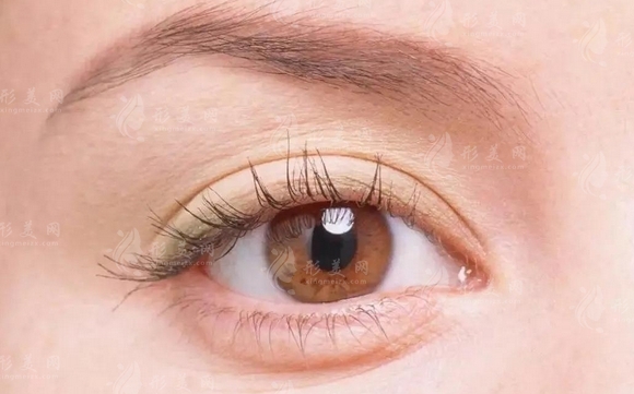全切雙眼皮手術(shù)與埋線雙眼皮:哪個(gè)更貴? 全切雙眼皮手術(shù)與埋線雙眼皮:哪個(gè)更貴?
