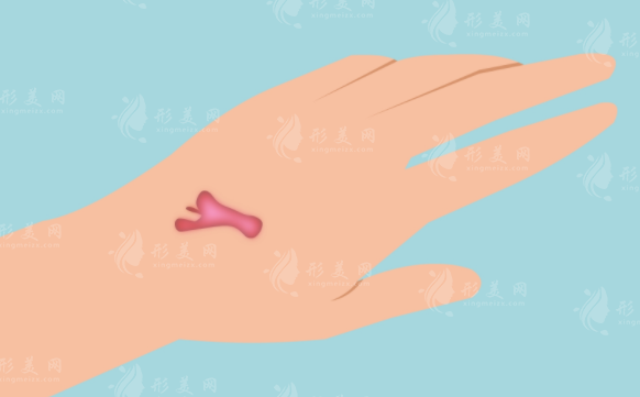 深圳鵬程醫(yī)院疤痕修復(fù)怎么樣？醫(yī)生名單、案例分析、價(jià)格明細(xì)