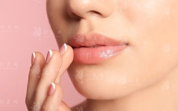 豐唇手術(shù)全解析：了解手術(shù)方法與注意事項