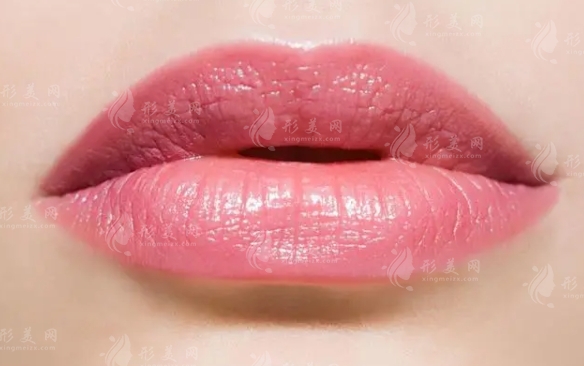 上唇過(guò)長(zhǎng)矯正后的疤痕處理