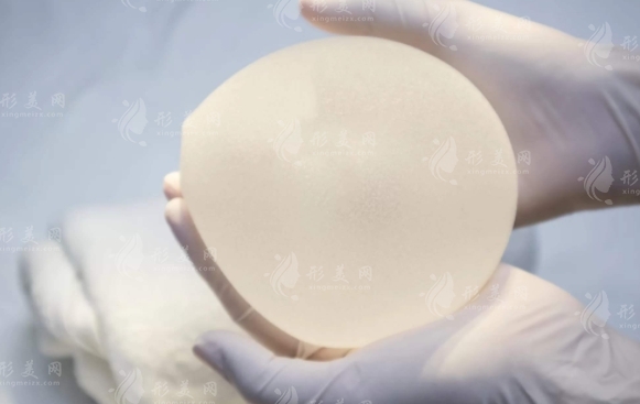 假體隆胸:長期性與對母乳喂養(yǎng)的影響 假體隆胸:長期性與對母乳喂養(yǎng)的影響