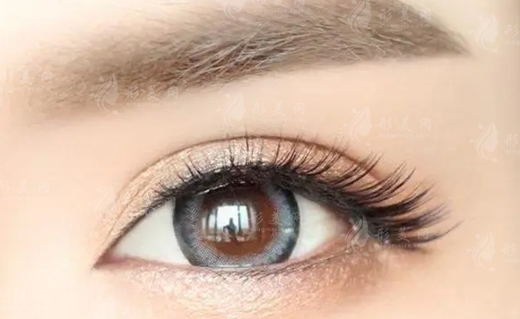 埋線雙眼皮術(shù)后效果不理想，用全切的方式修復(fù)有難度嗎？