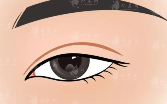 北京八大處雙眼皮修復(fù)價格一般多少錢？費用常見問題你問我答