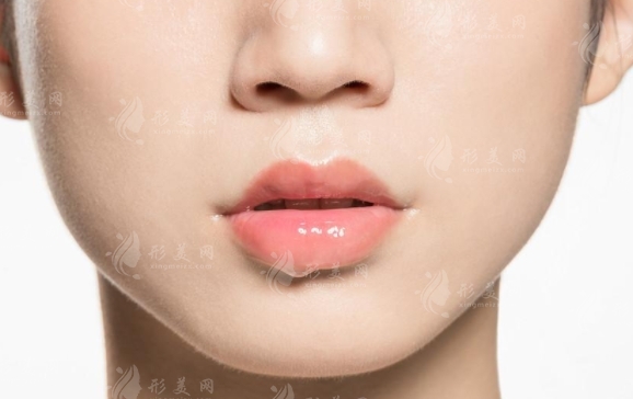 掌握這五大豐唇后注意事項，助你輕松邁向美麗新篇章