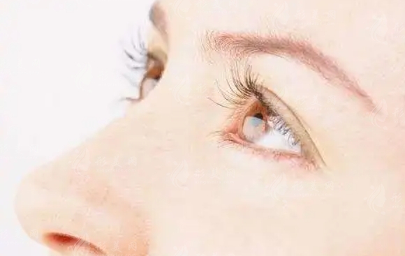 韓式三點(diǎn)雙眼皮：優(yōu)點(diǎn)與缺點(diǎn)的全面解析