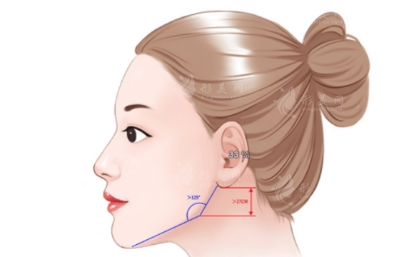 正頜手術(shù)的后遺癥與副作用