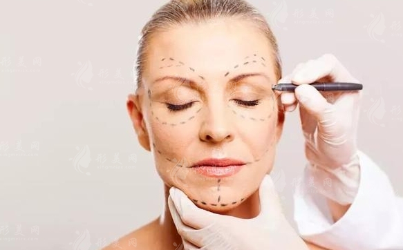 微創(chuàng)除皺：原理與常用方法解析