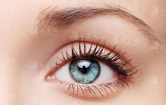 雙眼皮修復(fù)后為何會(huì)有難看的“肉條”？有瘢痕增生是失敗嗎？