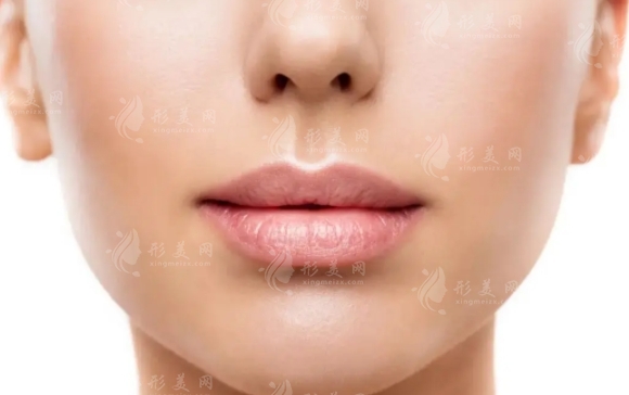 透明質(zhì)酸豐唇的特點及涂口紅注意事項