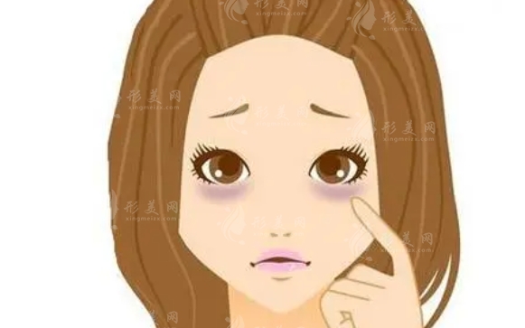 激光去黑眼圈的特點(diǎn)與適應(yīng)癥