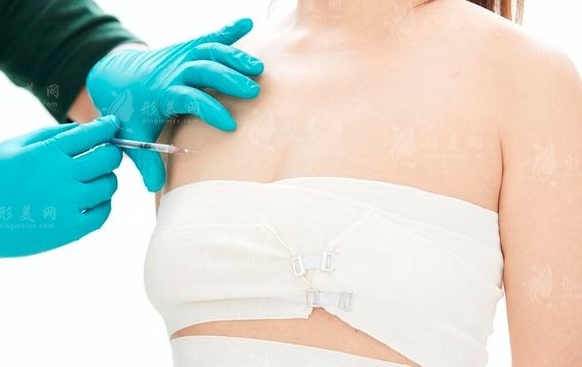 抽脂縮小巨乳術(shù)：術(shù)后效果、適合人群及潛在風(fēng)險(xiǎn)規(guī)避