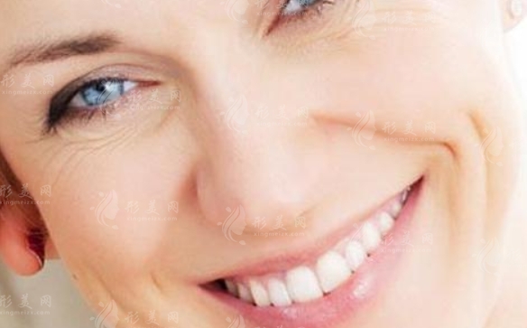 玻尿酸填充法令紋：詳細(xì)探討與解析