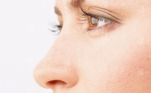 歪鼻整形修復(fù)與先天性及后天性歪鼻的區(qū)別