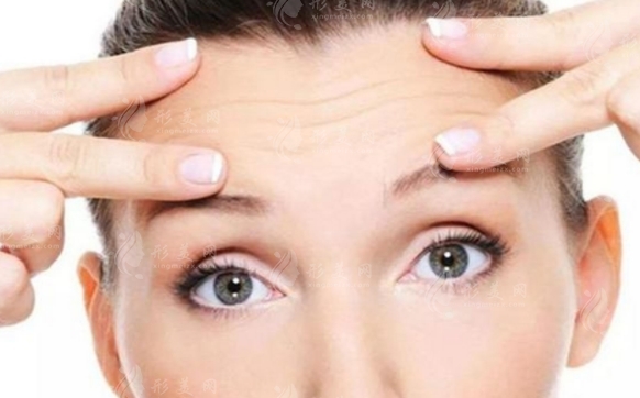 激光去除眉間紋的維持時間取決于哪些因素