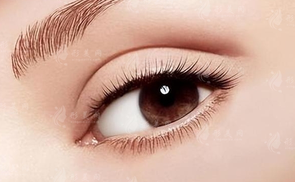 雙眼皮修復(fù)手術(shù)為何比初眼手術(shù)昂貴？詳解一覽