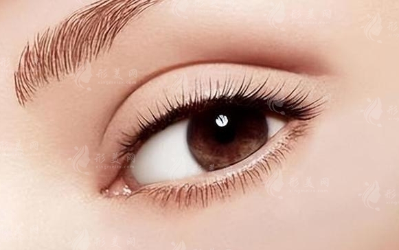 雙眼皮提肌解析：做雙眼皮手術一定要做提肌嗎？