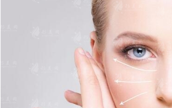 自體脂肪豐太陽穴：效果能維持多久？