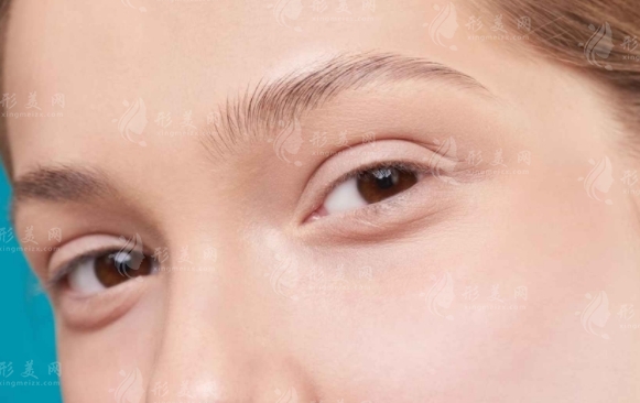 不開刀去眼袋靠譜嗎？調(diào)節(jié)方式有哪些？