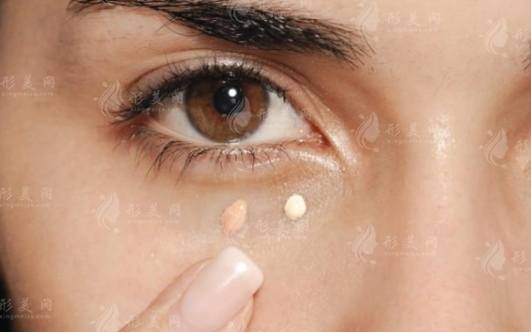 眼袋去除：割除術(shù)與微創(chuàng)祛眼袋手術(shù)的選擇探討
