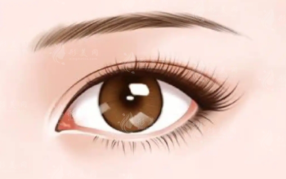 雙眼皮縫線法解析：效果是否永久？
