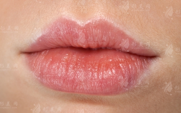 玻尿酸豐唇珠能維持多長時間？