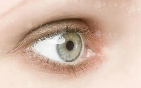 激光去黑眼圈：永久效果與適用人群探討