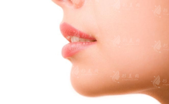 下頜角手術(shù)后增生的原因及解析