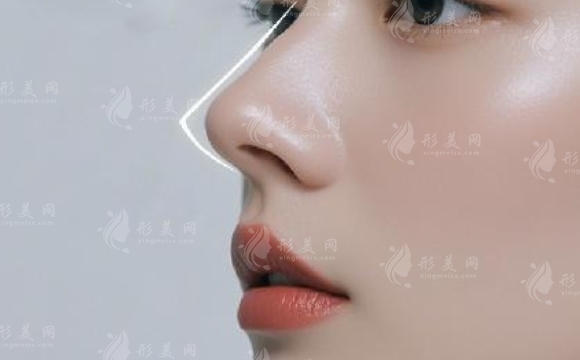 隆鼻手術(shù)后會(huì)面臨鼻頭攣縮的問(wèn)題嗎？