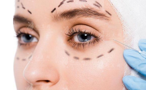 外切去眼袋會(huì)留下疤痕嗎？術(shù)后疤痕增生如何處理？