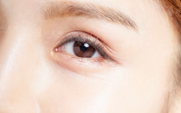 祛眼袋手術(shù)：效果維持與收費(fèi)價(jià)格解析
