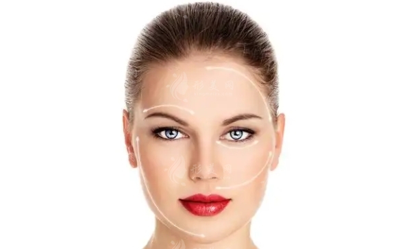 玻尿酸注射豐下巴：能否改變臉型及其效果探討