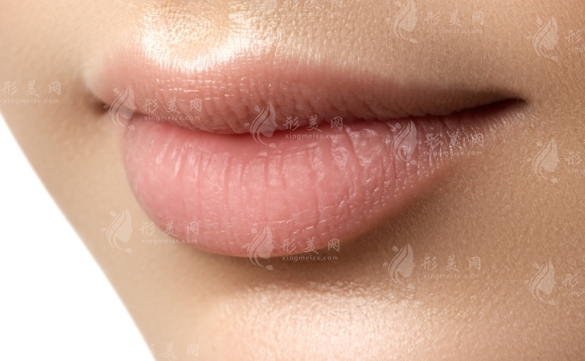 厚唇改薄手術：恢復時間與手術風險解析