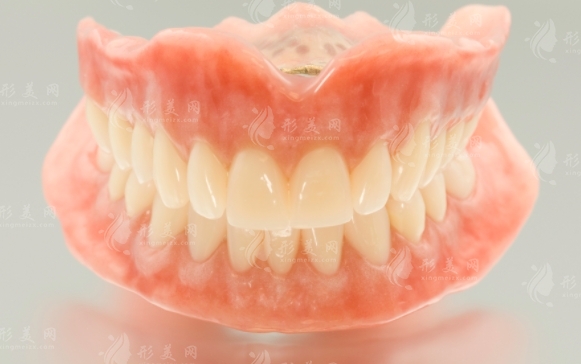 全瓷牙與烤瓷牙：哪個(gè)好？