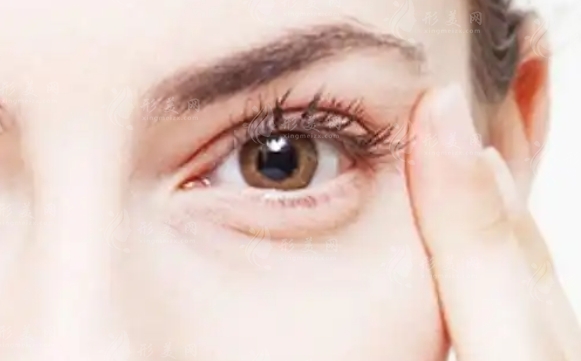 內(nèi)吸去眼袋：原理與注意事項(xiàng)