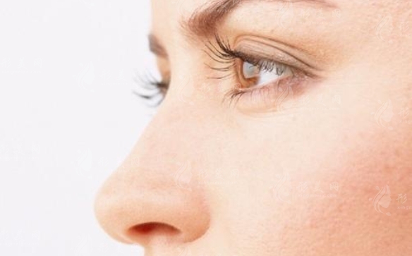 鼻綜合術(shù)后出現(xiàn)感染怎么辦？